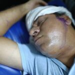 प्रॉपर्टी डीलर पर धार दार हथियारों से हमला, गंभीर हालत मे हायर सेंटर रेफर/रास्ते से बाइक हटाने की मामूली बात पर प्रापर्टी डीलर पर जान लेवा हमला